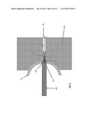 Acetabular Fixation System and Method diagram and image