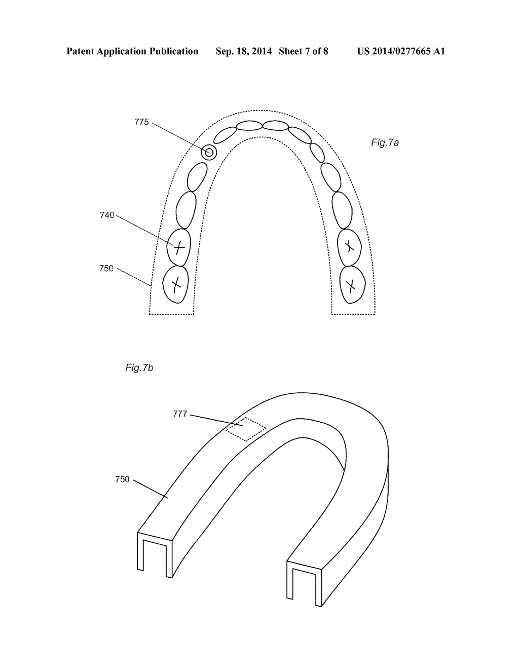 CUSTOMIZED DENTAL IMPRESSION TRAY - diagram, schematic, and image 08