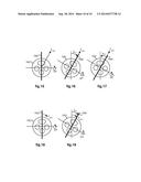 CONTROL OF MEDICAL ROBOTIC SYSTEM MANIPULATOR ABOUT KINEMATIC     SINGULARITIES diagram and image