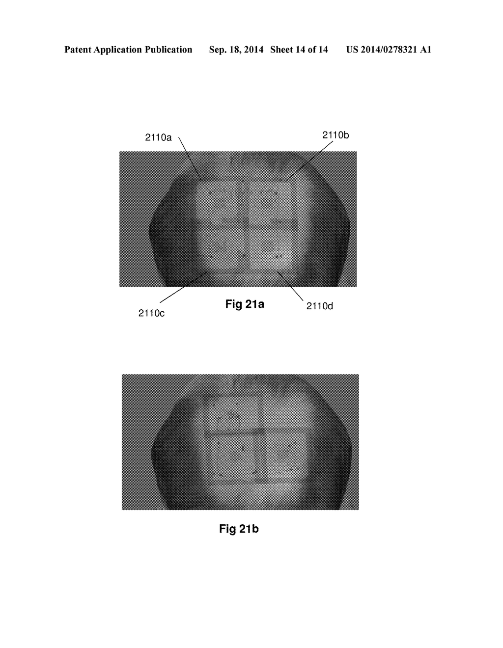 Systems and Methods for Planning Hair Transplantation - diagram, schematic, and image 15