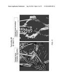 Rodents With Conditional Acvr1 Mutant Alleles diagram and image