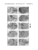 Genetically Modified Plants that are Insect-Resistant and/or Rot Resistant diagram and image