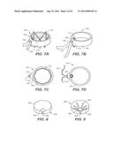 METHODS AND DEVICES FOR CRIMPING SELF-EXPANDING DEVICES diagram and image