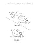 METHODS AND DEVICES FOR CRIMPING SELF-EXPANDING DEVICES diagram and image