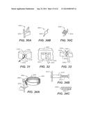 METHODS AND DEVICES FOR CRIMPING SELF-EXPANDING DEVICES diagram and image