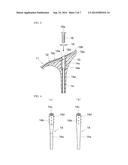 HEEL FIXING STRUCTURE FOR WOMEN S SHOE diagram and image