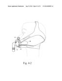 MASK FOR DELIVERY OF RESPIRATORY THERAPY TO A PATIENT diagram and image