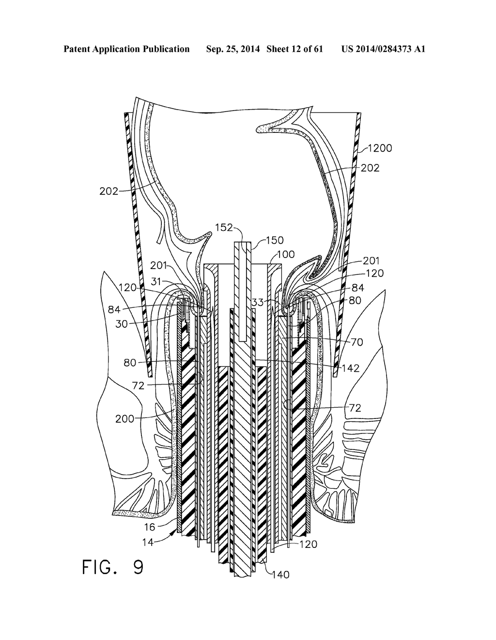 TISSUE ACQUISITION ARRANGEMENTS AND METHODS FOR SURGICAL STAPLING DEVICES - diagram, schematic, and image 13