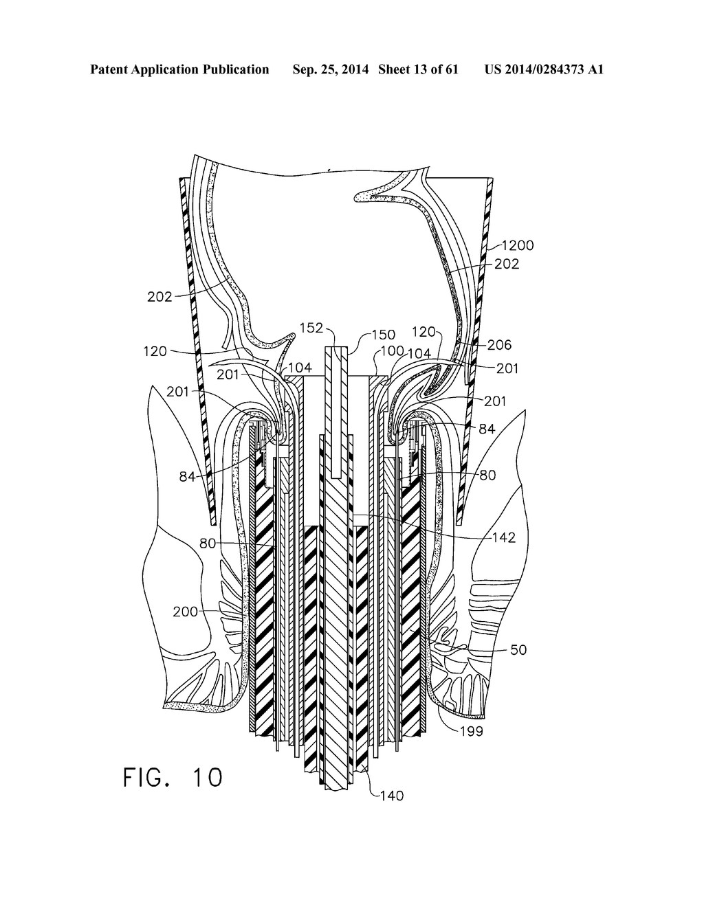 TISSUE ACQUISITION ARRANGEMENTS AND METHODS FOR SURGICAL STAPLING DEVICES - diagram, schematic, and image 14