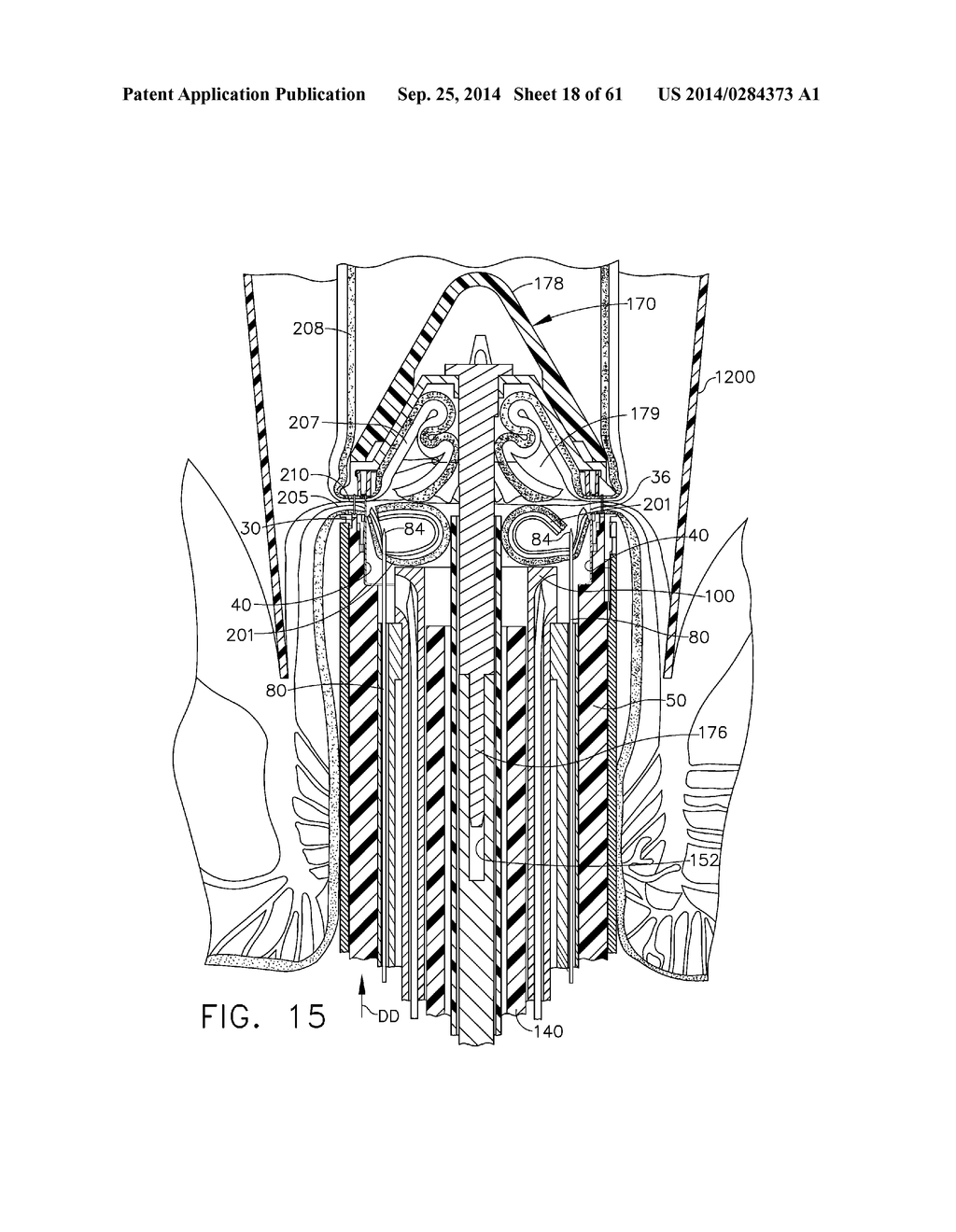 TISSUE ACQUISITION ARRANGEMENTS AND METHODS FOR SURGICAL STAPLING DEVICES - diagram, schematic, and image 19