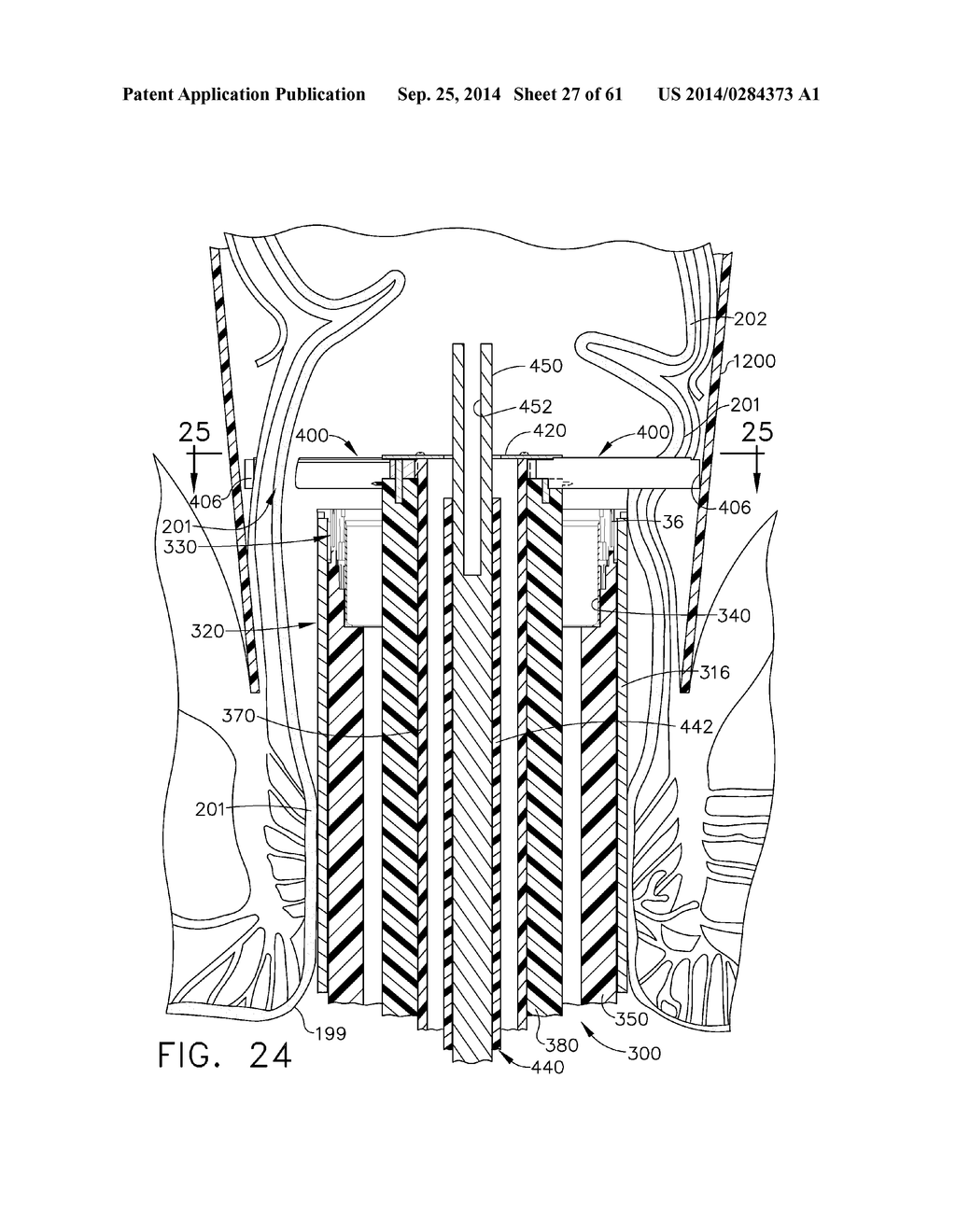 TISSUE ACQUISITION ARRANGEMENTS AND METHODS FOR SURGICAL STAPLING DEVICES - diagram, schematic, and image 28