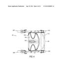 FOLDABLE WALKER APPARATUS diagram and image