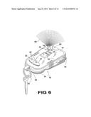 Panic Device With Local Alarm And Distal Signaling Capability diagram and image