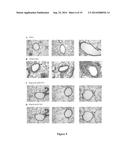 METHOD FOR TREATMENT OR PREVENTION OF ALLERGIC DISEASES diagram and image