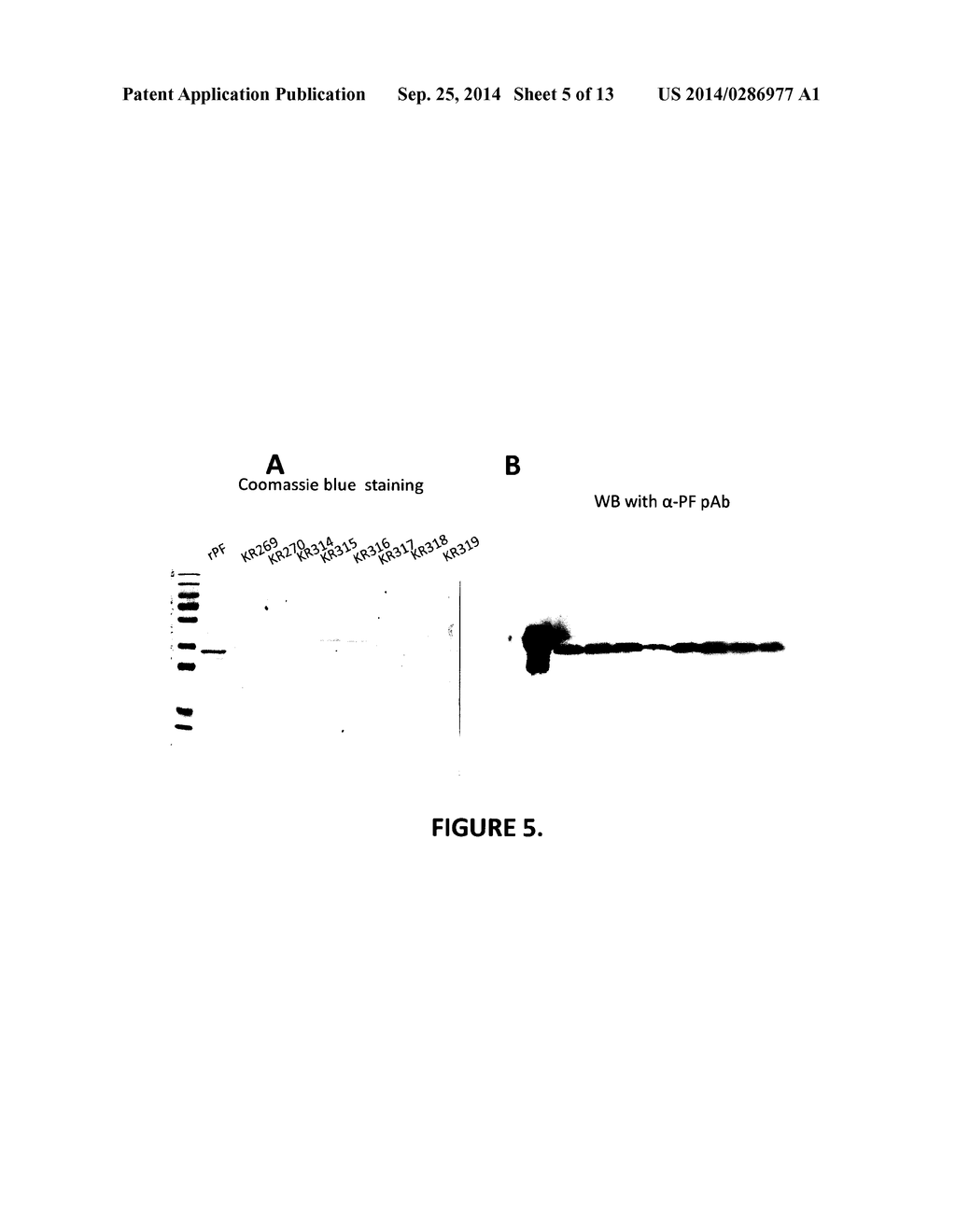 Protein F - A Novel Haemophilus Influenzae Adhesin with Laminin and     Vitronectin binding Properties - diagram, schematic, and image 06