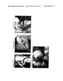 Solid Forms for Tissue Repair diagram and image