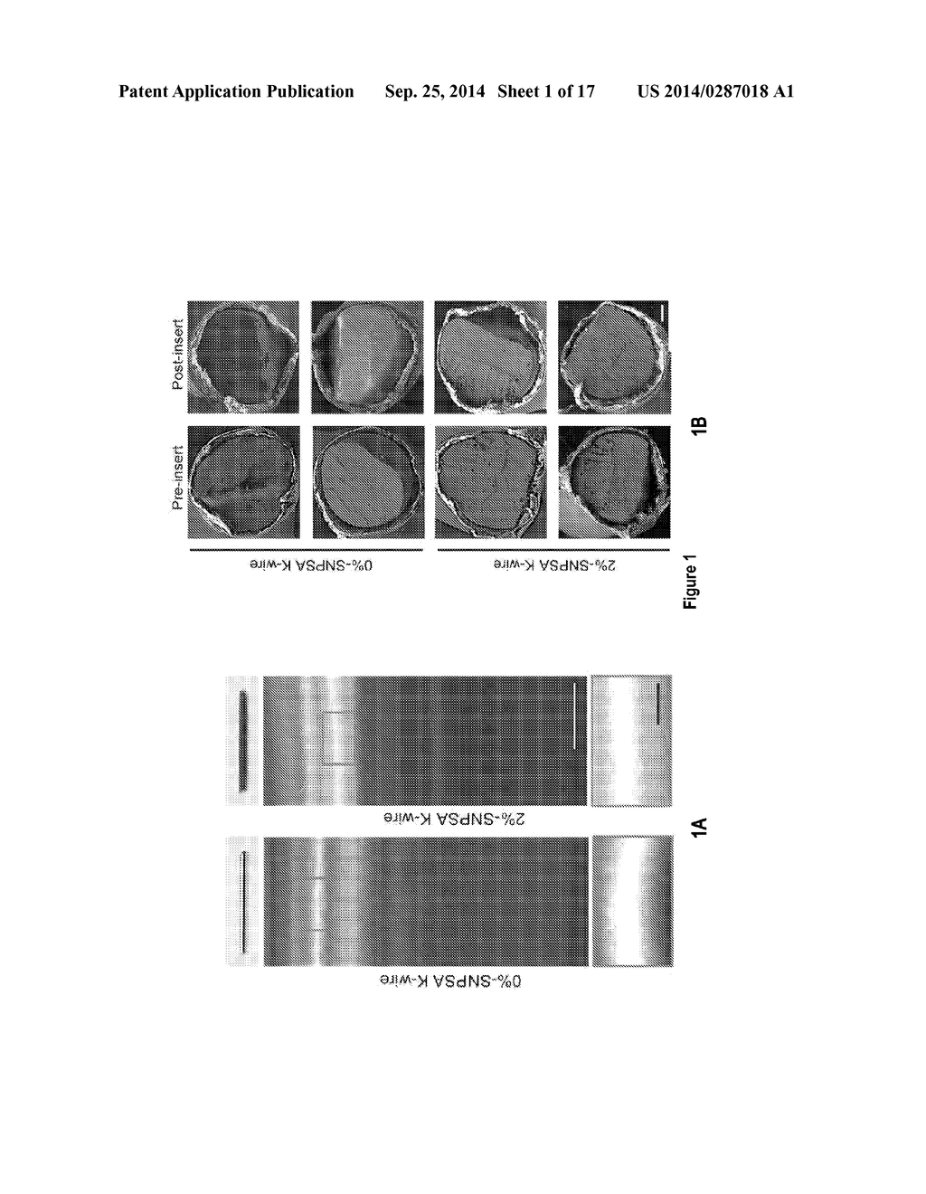 NANOPARTICLE-BASED SCAFFOLDS AND IMPLANTS, METHODS FOR MAKING THE SAME,     AND APPLICATIONS THEREOF - diagram, schematic, and image 02