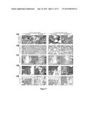 NANOPARTICLE-BASED SCAFFOLDS AND IMPLANTS, METHODS FOR MAKING THE SAME,     AND APPLICATIONS THEREOF diagram and image