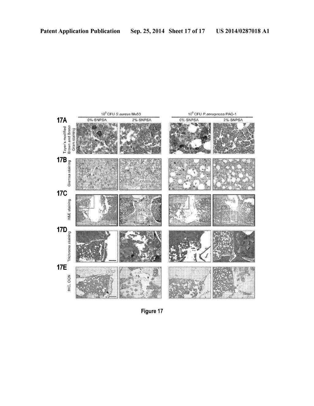 NANOPARTICLE-BASED SCAFFOLDS AND IMPLANTS, METHODS FOR MAKING THE SAME,     AND APPLICATIONS THEREOF - diagram, schematic, and image 18