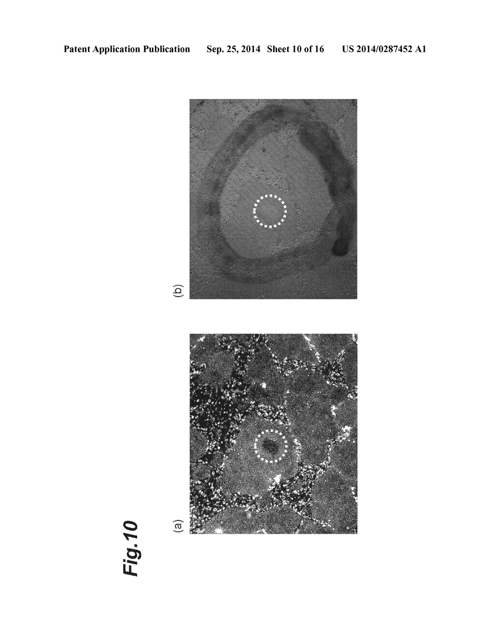 METHOD FOR OBSERVING STEM CELLS, METHOD FOR REMOVAL OF CELL REGION IN     STATE TENDING TOWARD DIFFERENTIATION, AND DEVICE FOR OBSERVING STEM CELLS - diagram, schematic, and image 11