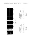 RNA INTERFERENCE SUPPRESSION OF NEURODEGENERATIVE DISEASES AND METHODS OF     USE THEREOF diagram and image