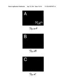 RNA INTERFERENCE SUPPRESSION OF NEURODEGENERATIVE DISEASES AND METHODS OF     USE THEREOF diagram and image