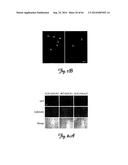 RNA INTERFERENCE SUPPRESSION OF NEURODEGENERATIVE DISEASES AND METHODS OF     USE THEREOF diagram and image