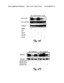 RNA INTERFERENCE SUPPRESSION OF NEURODEGENERATIVE DISEASES AND METHODS OF     USE THEREOF diagram and image