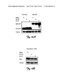 RNA INTERFERENCE SUPPRESSION OF NEURODEGENERATIVE DISEASES AND METHODS OF     USE THEREOF diagram and image