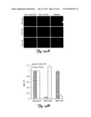 RNA INTERFERENCE SUPPRESSION OF NEURODEGENERATIVE DISEASES AND METHODS OF     USE THEREOF diagram and image