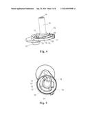 TENSIONER diagram and image