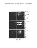 COMPOSITIONS AND METHODS TO CONCURRENTLY TREAT AND/OR PREVENT MULTIPLE     DISEASES WITH CUPREDOXINS diagram and image