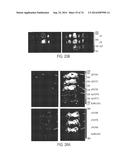 COMPOSITIONS AND METHODS TO CONCURRENTLY TREAT AND/OR PREVENT MULTIPLE     DISEASES WITH CUPREDOXINS diagram and image