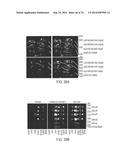 COMPOSITIONS AND METHODS TO CONCURRENTLY TREAT AND/OR PREVENT MULTIPLE     DISEASES WITH CUPREDOXINS diagram and image