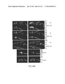 COMPOSITIONS AND METHODS TO CONCURRENTLY TREAT AND/OR PREVENT MULTIPLE     DISEASES WITH CUPREDOXINS diagram and image