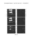 COMPOSITIONS AND METHODS TO CONCURRENTLY TREAT AND/OR PREVENT MULTIPLE     DISEASES WITH CUPREDOXINS diagram and image