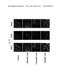 USE OF PHOSPHODIESTERASE INHIBITORS FOR TREATING MULTIDRUG RESISTANCE diagram and image