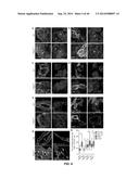 USE OF TRANSLATIONAL PROFILING TO IDENTIFY TARGET MOLECULES FOR     THERAPEUTIC TREATMENT diagram and image