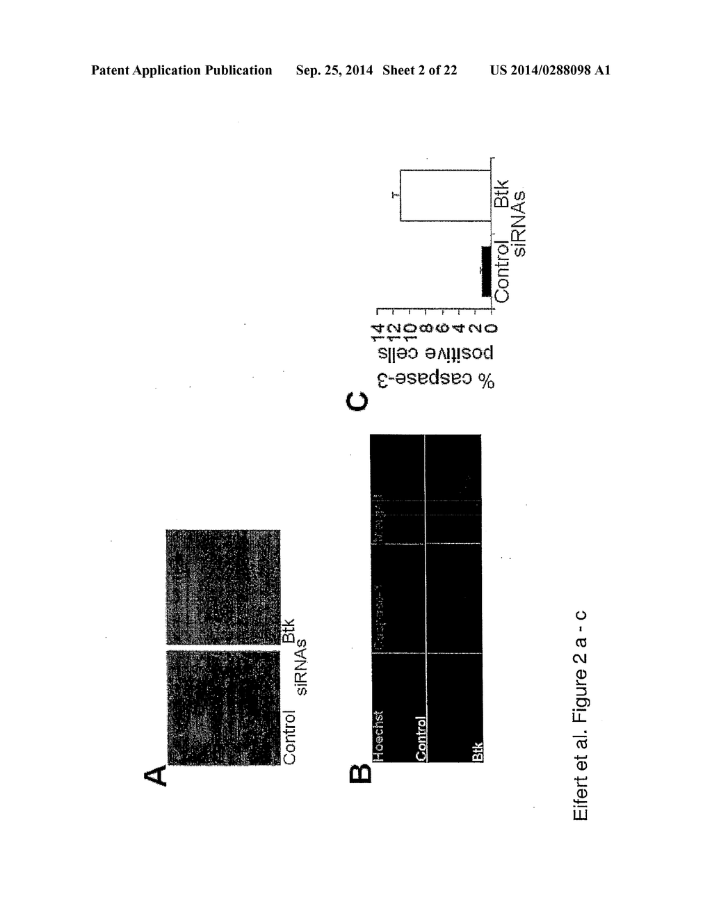 Bruton's Tyrosine Kinase As Anti-Cancer Drug Target - diagram, schematic, and image 03