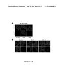 Bruton s Tyrosine Kinase As Anti-Cancer Drug Target diagram and image