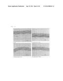 DRIED AND IRRADIATED SKIN EQUIVALENTS FOR READY USE diagram and image