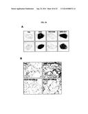 HUMAN MONOCLONAL ANTIBODY NEUTRALIZING VASCULAR ENDOTHELIAL GROWTH FACTOR     RECEPTOR AND USE THEREOF diagram and image