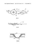 SURGICAL PORTAL WITH SEAL SYSTEM diagram and image