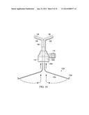 Retractable Cannula for Surgical Procedures diagram and image