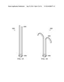 Retractable Cannula for Surgical Procedures diagram and image