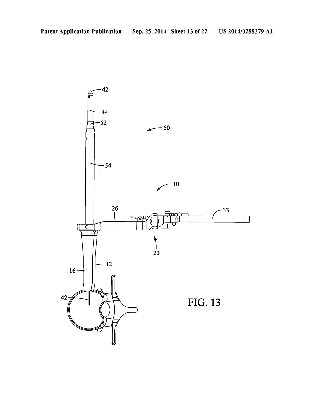 SURGICAL ACCESS SYSTEM AND RELATED METHODS - diagram, schematic, and image 14