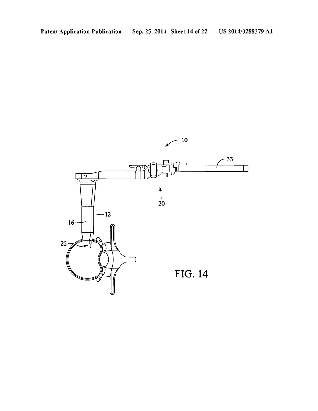 SURGICAL ACCESS SYSTEM AND RELATED METHODS - diagram, schematic, and image 15