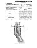 Plurality of Lamination for Soft Tissue Compression Support, Protection     and Bracing; Intelligent Textile for Equine and Equestrian Sports or     Activities diagram and image