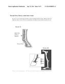 Plurality of Lamination for Soft Tissue Compression Support, Protection     and Bracing; Intelligent Textile for Equine and Equestrian Sports or     Activities diagram and image