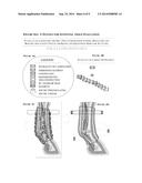 Plurality of Lamination for Soft Tissue Compression Support, Protection     and Bracing; Intelligent Textile for Equine and Equestrian Sports or     Activities diagram and image